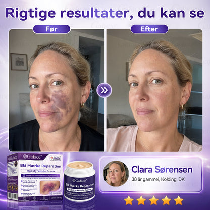 🧧[110𝒌+ 𝑺𝒐𝒍𝒈𝒕] ✨𝑮𝒂𝒇𝒂𝒄𝒆® 𝑩𝒍å 𝑴æ𝒓𝒌𝒆 𝑹𝒆𝒑𝒂𝒓𝒂𝒕𝒊𝒐𝒏 𝑯𝒖𝒅𝒔𝒕𝒚𝒓𝒌𝒆𝒏𝒅𝒆 𝑪𝒓𝒆𝒎𝒆