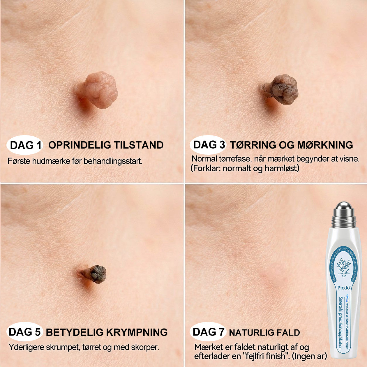 💖🌻𝐏i𝐜𝐝o®7-𝑫𝒂𝒈𝒆𝒔 𝑯𝒖𝒅𝒗æ𝒌𝒔𝒕 𝑶𝒈 𝑷𝒊𝒈𝒎𝒆𝒏𝒕𝒑𝒍𝒆𝒕𝒕𝒆𝒓 𝑭𝒋𝒆𝒓𝒏 𝑷𝒆𝒏𝒏𝒆𝒏(Nul smerte, nul ar Rollerball)💪